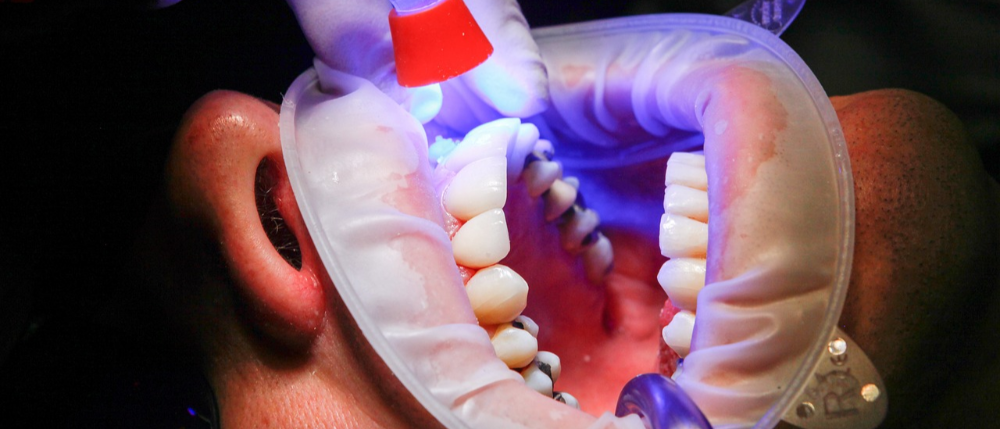  Zahngesundheit fördern durch regelmäßige Kontrolluntersuchungen